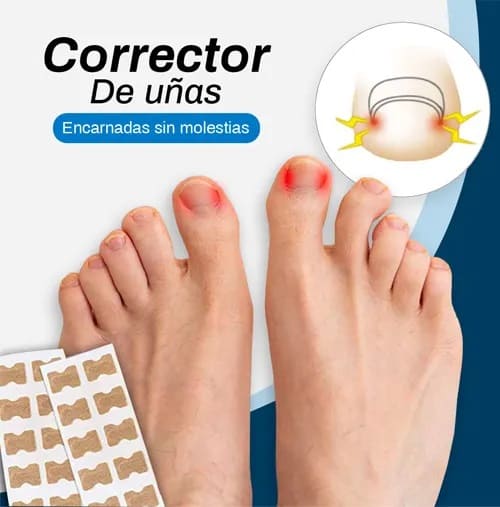 PARCHES CORRECTORES DE UÑAS ⭐⭐⭐⭐⭐